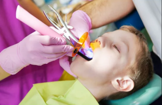 Dental Fillings Fort Worth