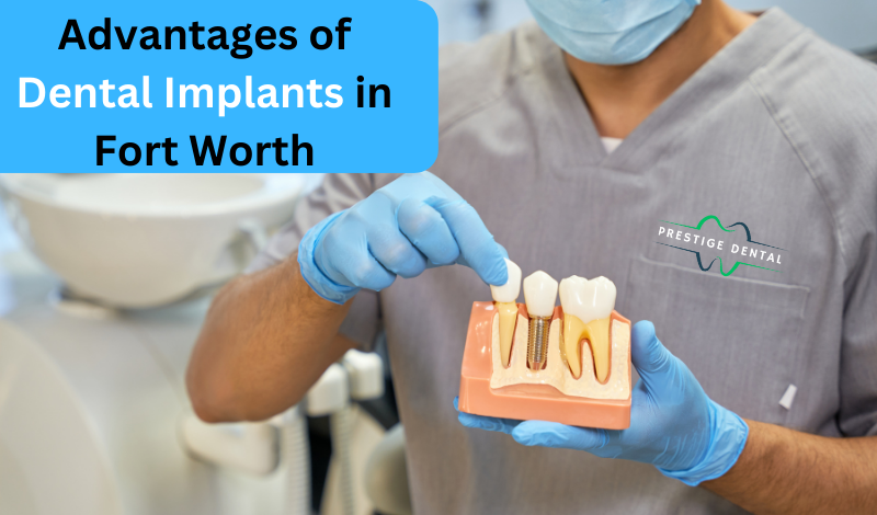 Advantages of Dental Implants in Fort Worth