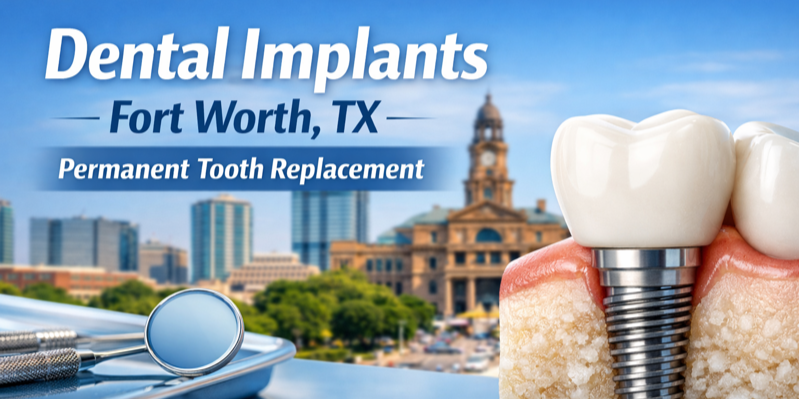 Dental Implants Fort Worth: The Best Solution for Missing Teeth